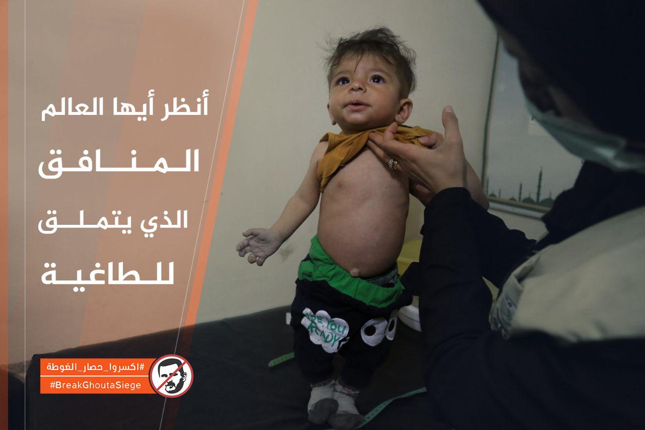 حدث وتعليق - اكسروا حصار الغوطة