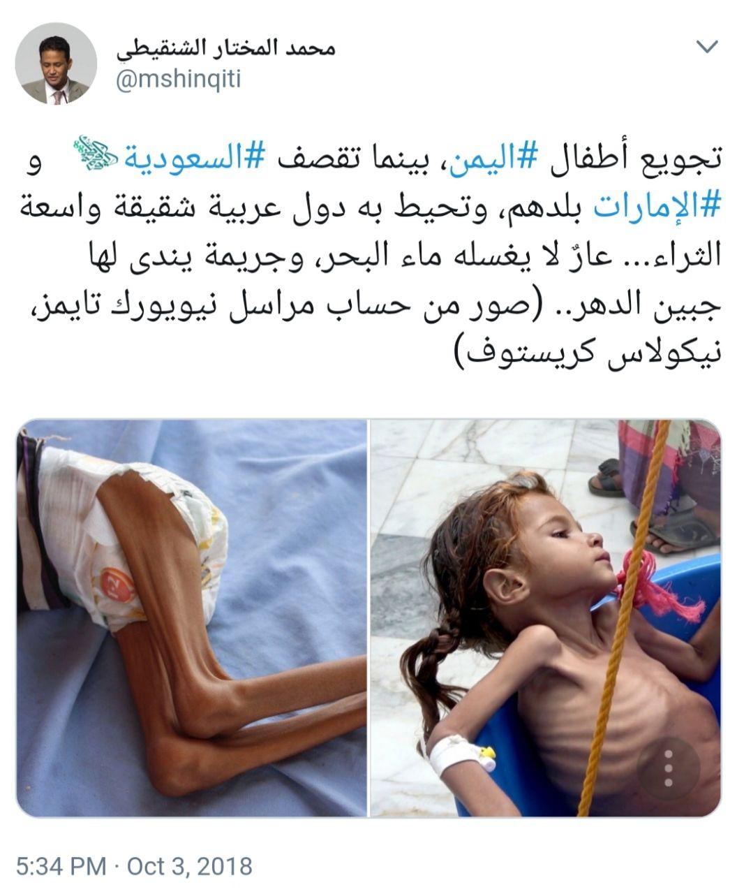 حدث وتعليق - المجاعة في اليمن