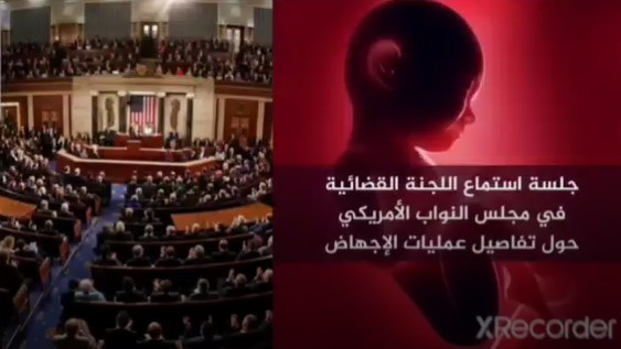 الاجهاض